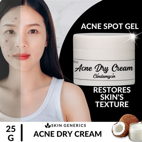 [ Anti Bacterial Acne Treatment ] Skingenerics Acne Dry Cream Anti