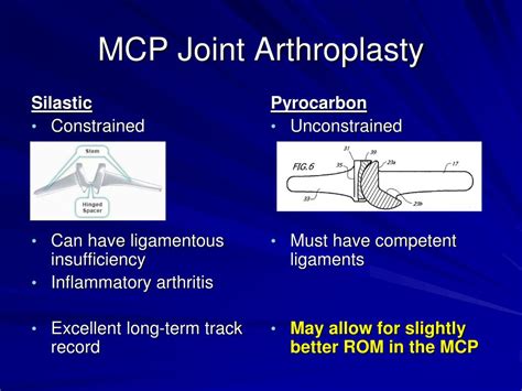 Ppt Hand And Wrist Arthritis Powerpoint Presentation Free Download Id 3334206