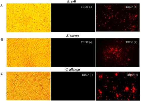 Membrane Permeabilization Of Hybrid Peptide On E Coli A S Aureus Download Scientific