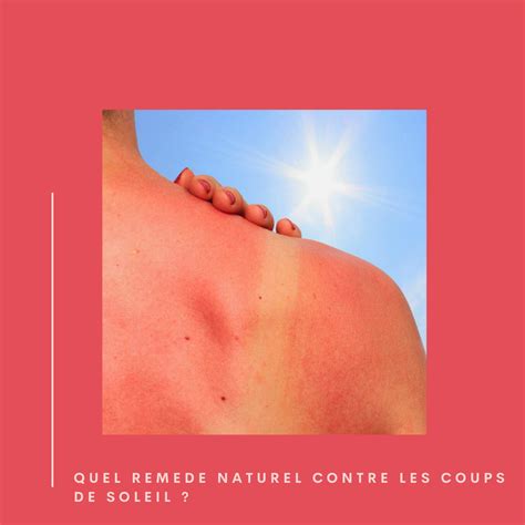 Coup De Soleil Quel Remède Naturel Contre Les Coups De Soleil Tout