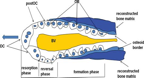 Bone Remodeling Osteoporosis