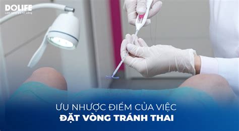 Chi tiết ưu nhược điểm của đặt vòng tránh thai và các lưu ý khi thực