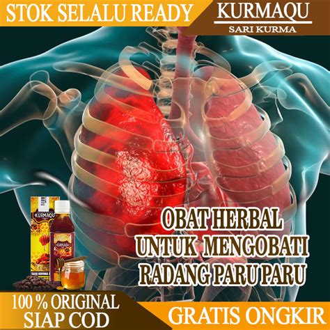 Jual Obat Radang Paru Paru Obat Untuk Mengatasi Radang Paru Paru Obat