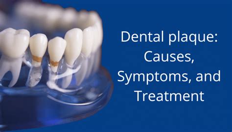 Dental Plaque Causes Symptoms And Treatment Vistadent