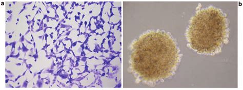 Photographs Of U Human Glioma Cells Grown In Culture As A Monolayer