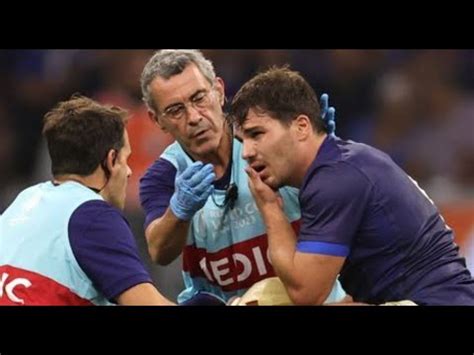 Coupe Du Monde Rugby Antoine Dupont Souffre D Une Fracture Maxillo