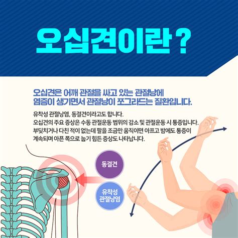 어깨 오십견 염증 견관절을 둘러싸고 손꿀팁