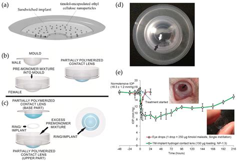 Materials Free Full Text Therapeutic Contact Lenses With Polymeric