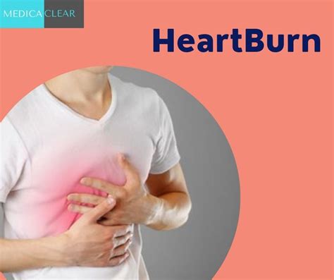 Heartburn Gerd Definition Causes Symptoms Complications And