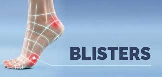 How To Heal A Popped Blister Quickly And Easily Heidi Salon