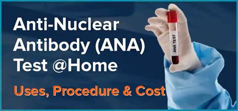 Anti Nuclear Antibody ANA Test At Home Uses Procedure And Cost