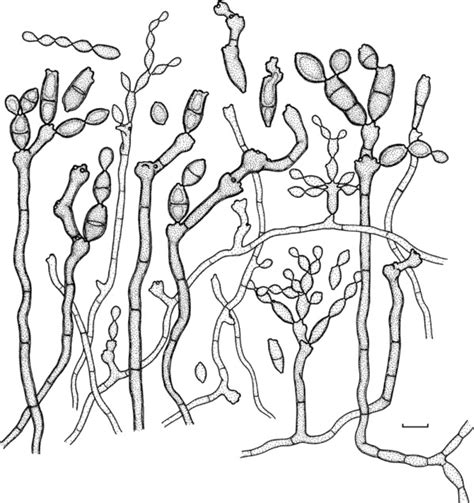 Cladosporium Macrocarpum Cbs 29967 Macro And Micronematous