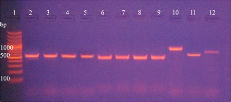 Ethidium Bromide Stained Agarose Gel With Its Amplicons Lane