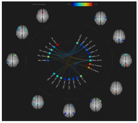 JCM | Free Full-Text | Widespread Intra- and Inter-Network ...