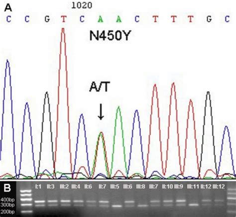 Dna Sequence Chromatograms And Co Segregation Analysis Of The Pn450y