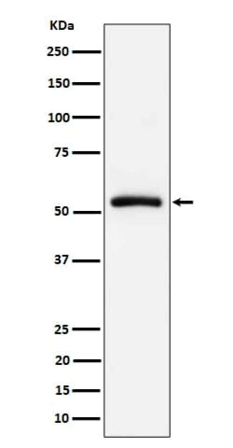 CAP1 Antibody SR1982 Novus Biologicals 50 μg Unconjugated