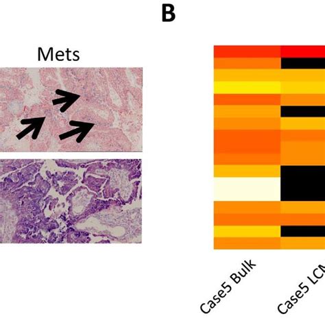 Validation Of Mirna Expression A In Situ Hybridization Of Mir 21