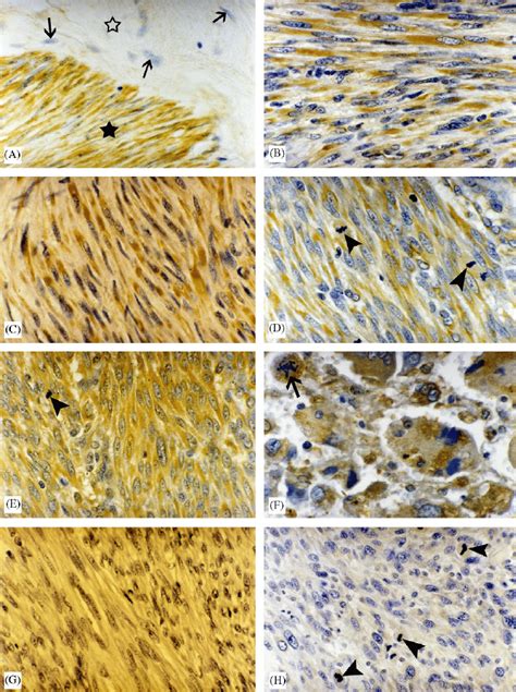 A Normal Myometrium Stained With Mabh High Expression Of Epitope H