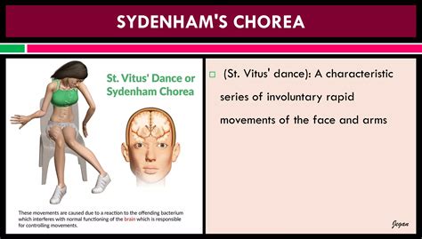 Pathophysiology Of Rheumatic Fever Ppt