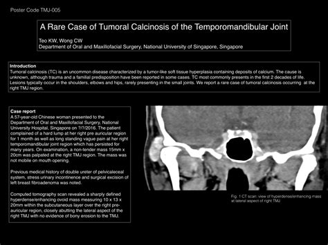 Pdf A Rare Case Of Tumoral Calcinosis Of The Temporomandibular Joint