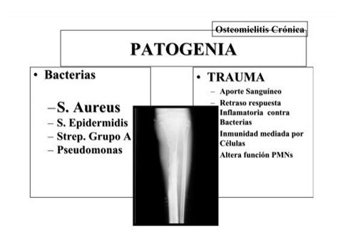 Patogenia Osteomielitis C