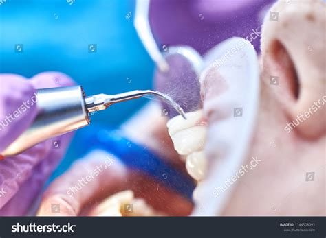 2,089 Dental scaler Images, Stock Photos & Vectors | Shutterstock