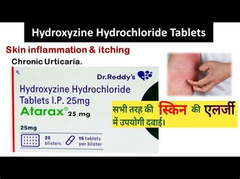 Hydroxyzine Hydrochloride Tablets || Atarax Tablets |Tablet for skin ...