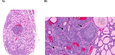 Thyroid Histology C Cells