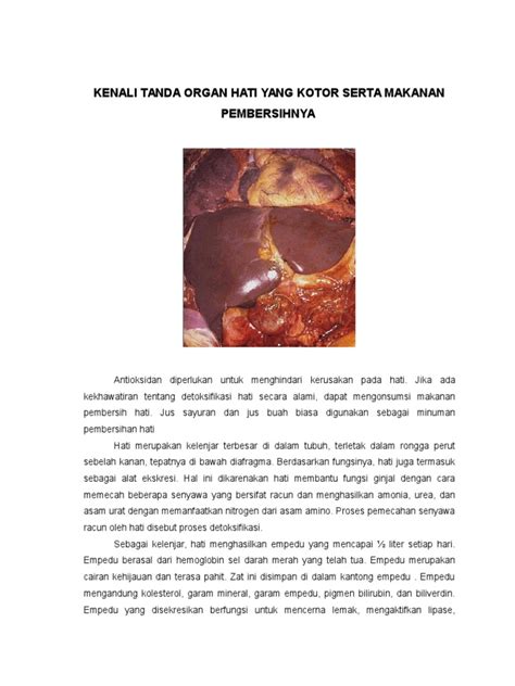 Gambar Obat Vitamin Liver Kesehatan Fungsi Hati Mengenal Organ Beserta