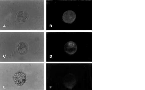 Immunolocalization Of Monocyte Chemotactic Protein Mcp In The