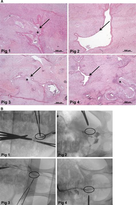 A Retrograde Urethrography 2 Weeks After Urethral Reconstruction With Download Scientific