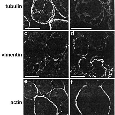 Effect Of Nocodazole On The Cytoskeleton In T L Adipocytes T L