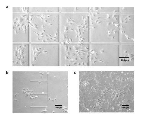 Human Umbilical Vein Endothelial Cells Huvecs Seeded Onto A Test