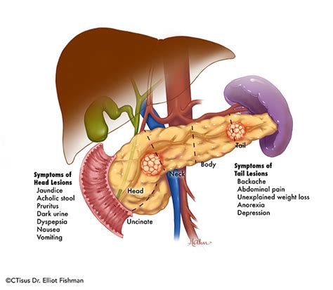 Pancreas Anatomy Uncinate