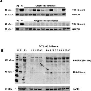 Western Blot Analysis Of Selected Proteins A Expression Of Tr In A