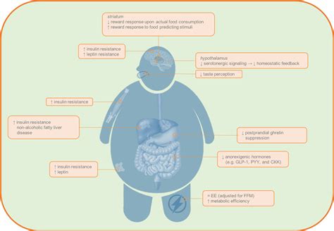 The Pathogenesis Of Obesity Metabolism Clinical And Experimental