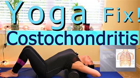 Costochondritis Physical Therapy Exercises Atelier Yuwaciaojp