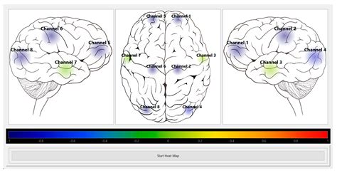 MPs Free Full Text Non Invasive Mapping Of Cerebral Autoregulation