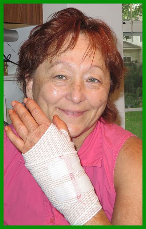 Carpal Tunnel Surgery Thoughts Tips And Tales