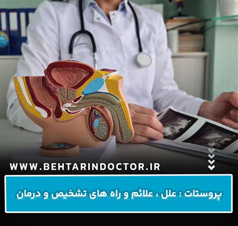 پروستات علل ، علائم و راه های تشخیص و درمان بهترین دکتر