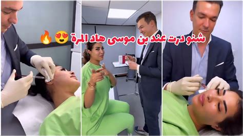 مشيت عند الدكتور بن موسى كعدت الجمال😍 ها شنو درت هاد المرة ️🔥 Soukaina