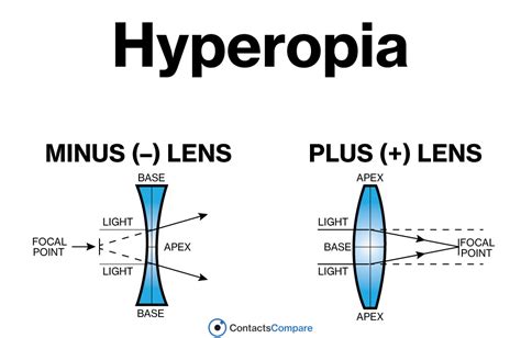 Hyperopia Diagram