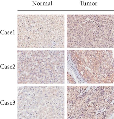 Cenpu Expression In Hcc Tissues And Cell Lines A B Cenpu Mrna And