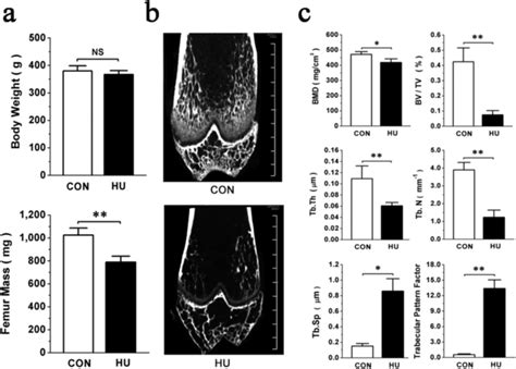 Hind Limb Unloading Significantly Inhibits Bone Formation In Vivo A Download Scientific