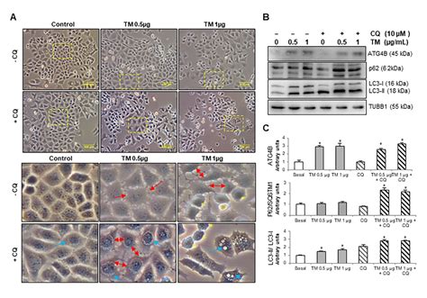 Impaired Autophagic Activity And Atg B Deficiency Are Associated With