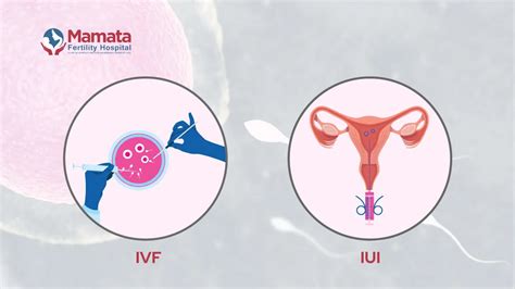 Differences Between Ivf And Iui You Must Know