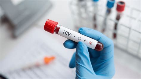 Hiv Vaccine Nears Clinical Trial After Passing Key Safety Test Iflscience