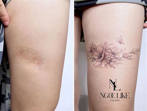 50 Times People Asked To Cover Up Their Scars And This Tattoo Artist Nailed It New Pics Artofit