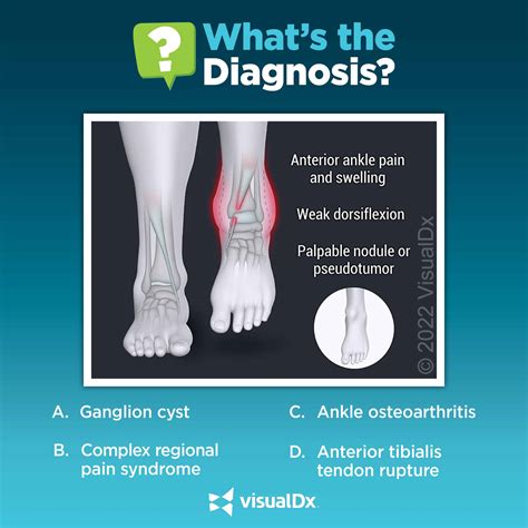 Anterior ankle pain and gait disturbance - Let’s diagnose