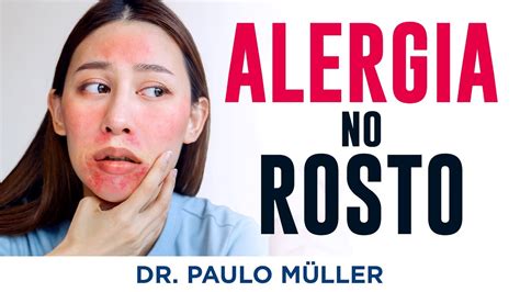 Alergia Que Incha O Rosto - Urticaria No Pescoco E Rosto Alergias Na Pele: O Que São, Sintomas,
